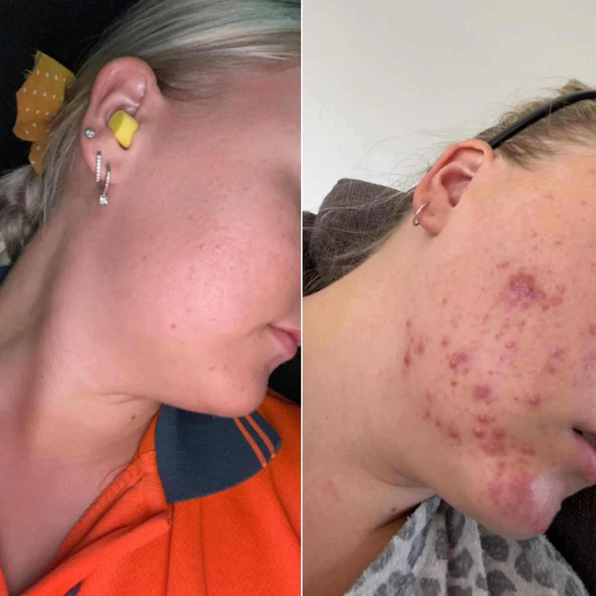 Hydrating Heroes Starter Set - Image 4